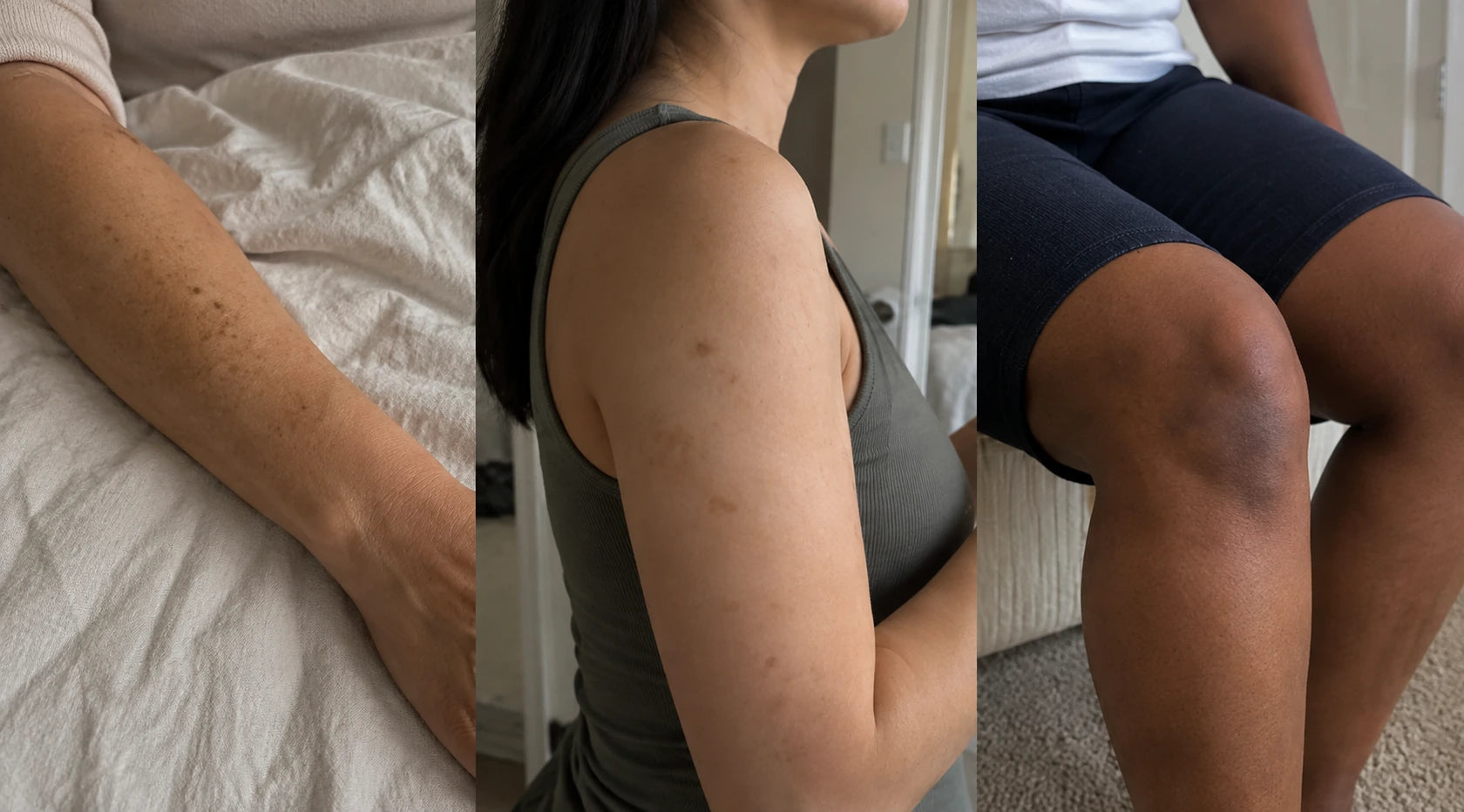 Three separate body-skin illustrations showing a forearm, shoulder and knee with natural tone variation; not a before-and-after